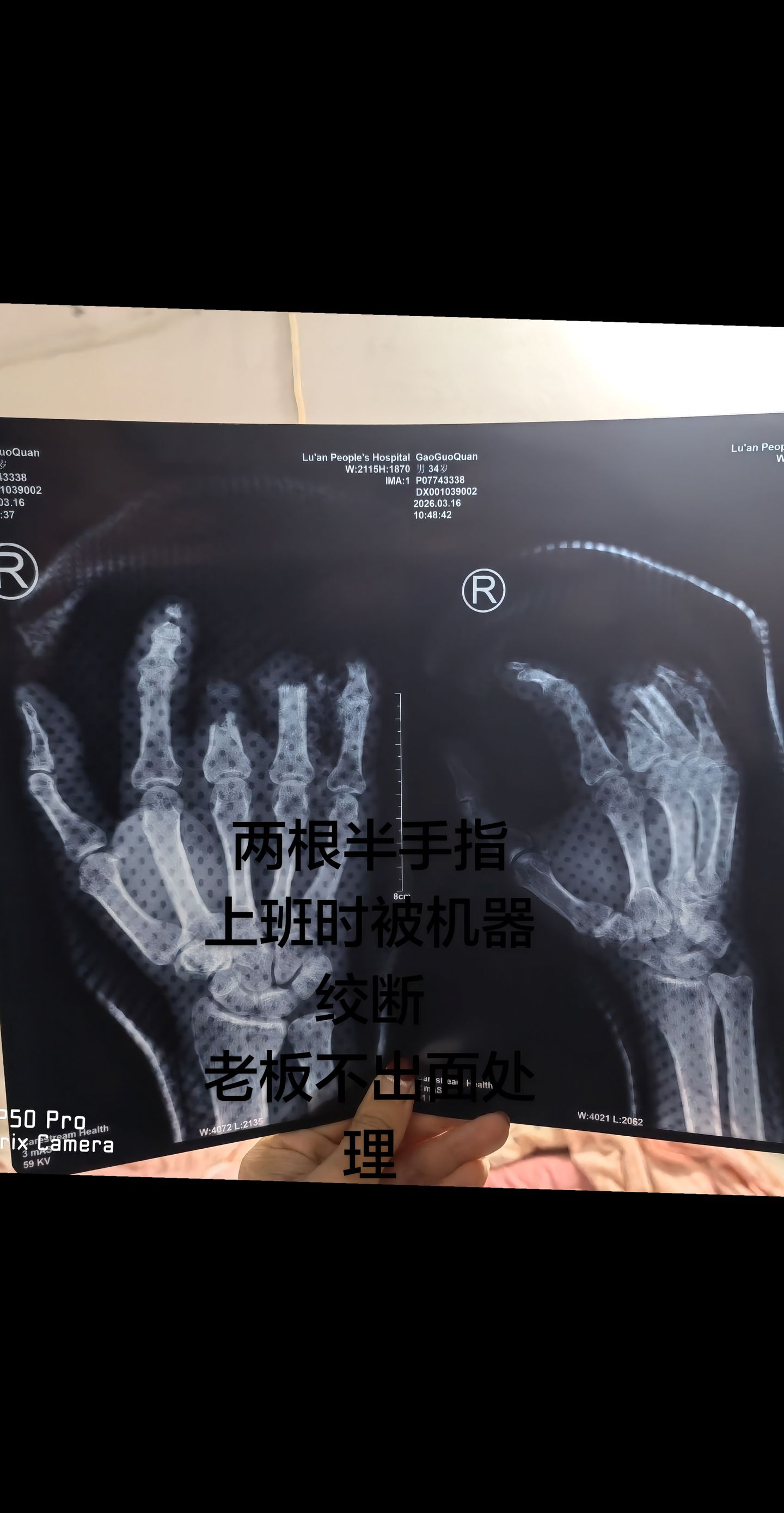 附带内容