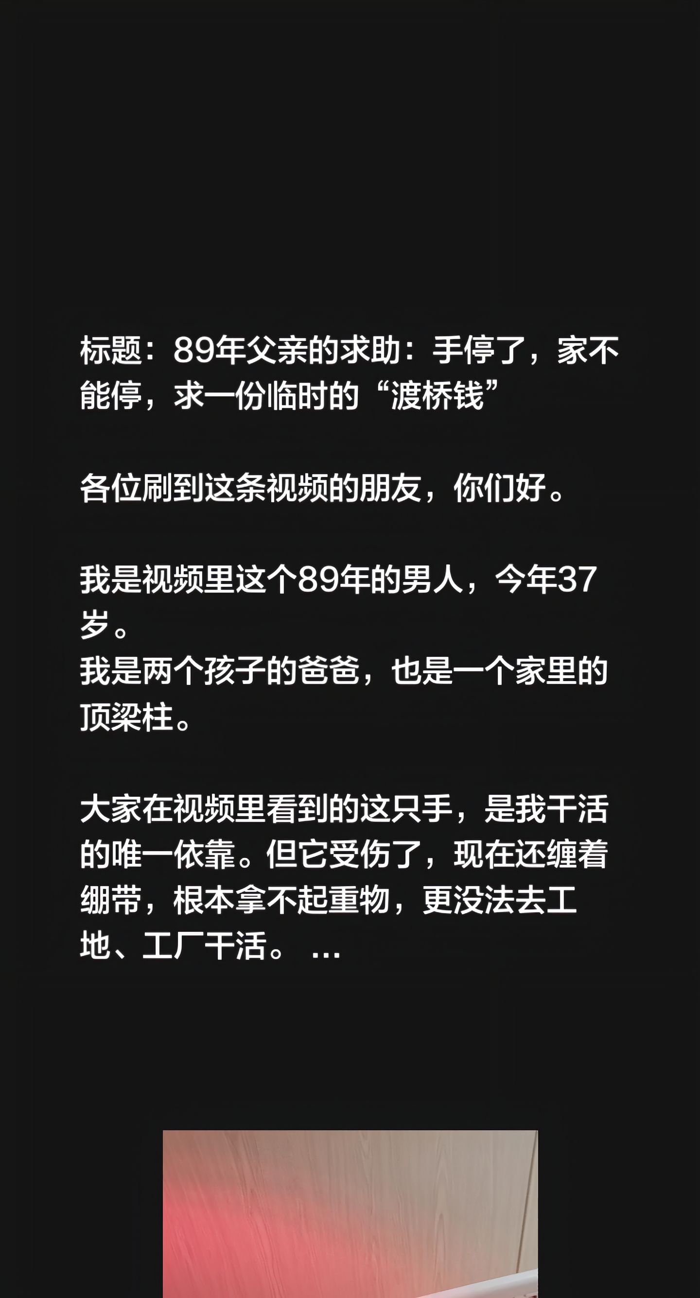 “这只手，是我干活的唯一依靠。但它受伤了，现在还缠着绷带，根本拿不起重物，更没法去工地、工厂干活。”

3月9日，抖音博主“三妹三”发布了视频《89年父亲的求助：手停了，家不能停，求一份临时的“渡桥钱
